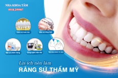 Răng sứ cao cấp uy tín TPHCM